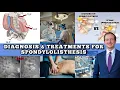 The BEST on Spondylolisthesis How to Diagnose the Many Treatments Spine Surgeon