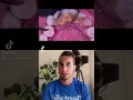 Download Lagu ✅CÓMO QUITAR el SARRO dental en el DENTISTA😷 - Tratamiento rápido y sencillo #shorts