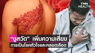  โรคงูสวัสดิ์เกิดจากอะไร และมีอาการอย่างไรบ้าง 