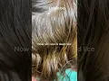 Download Lagu Eliminating lice with the best lice treatment