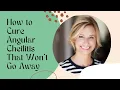 How To Cure Angular Cheilitis That Won t Go Away - Angular Cheilitis Won t Go Away