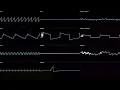 Cover Level Up Intro Music