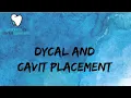 Dycal \u0026 Cavit - Mix/Apply Temporary Filling (Cavit) - Dental Assistant