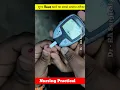 Lagu HOW TO CHECK RANDOM BLOOD SUGAR (RBS)