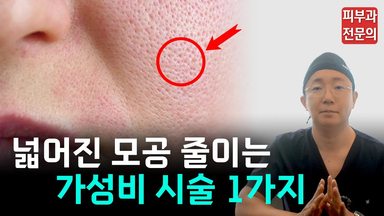 [피부] 넓어진 모공 줄이는 가성비 시술 1가지