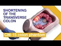 Basic Techniques of Colonoscope Insertion Exercise 4 Shortening of the transverse colon