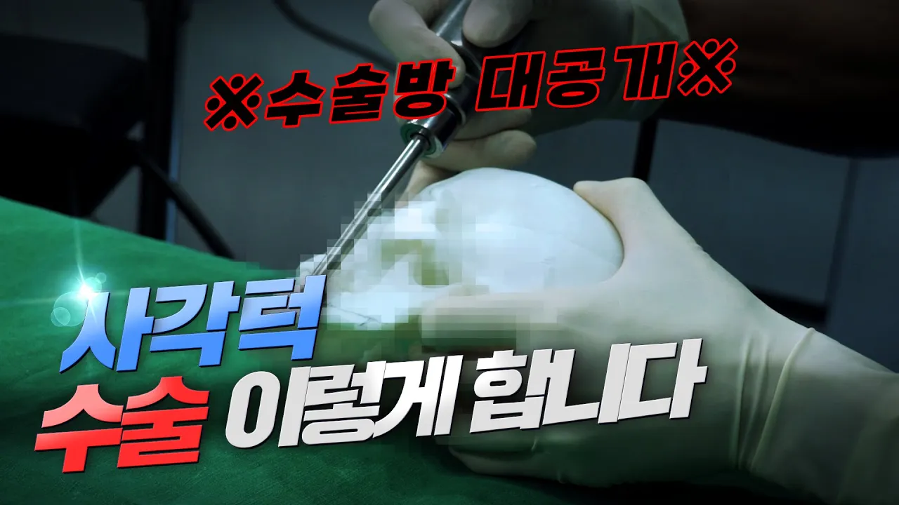 ※수술방 대공개※ 사각턱 수술 어떻게 하는지 아세요? 이렇게 합니다