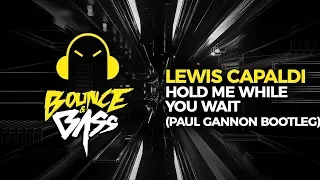 Download Lewis Capaldi - Hold Me While You Wait  (Paul Gannon Bootleg) MP3