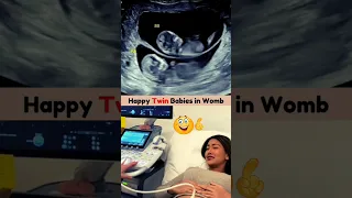 Emotional Twin Ultrasound Scan