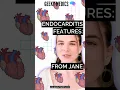 Download Lagu Features of infective endocarditis: FROM JANE