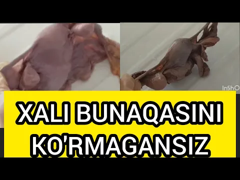 AYOLLAR JINSIY ORGANI OCHIQ KORSATILDI