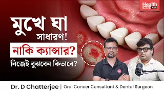 মুখে ঘা হলে কি করণীয়? মুখের ঘা কেমন হলে বুঝবেন ক্যান্সারের লক্ষণ? Oral Cancer Symptoms & Treatment