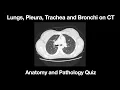 The Lungs Pleura Trachea and Bronchi Anatomy and Pathology Quiz