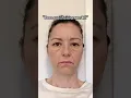 Does gua sha even work You tell us