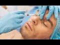Tenoplasty CPT code - simplify medical coding