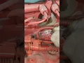 Manifold Pressure Sensor Cleaning for the 2019 ISX-15