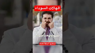 حل الهالات السوداء  في دقيقة  دكريم على  فكر تانى دندنها
