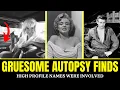 Gruesome AUTOPSY Reports of 15 Golden Age Celebrities