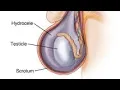 Causes of scrotal swelling
