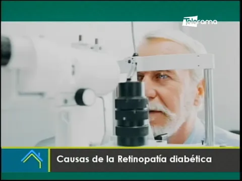 Causas de la retinopatía diabética