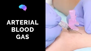 How To Take An Arterial Blood Gas ABG OSCE Guide UKMLA CPSA PLAB 2 