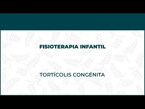 Tortícolis Congénita. Fisioterapia Infantil - FisioClinics Madrid