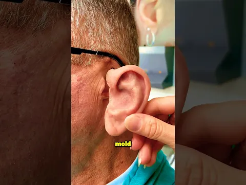 How Doctors Make Silicone Ears‼️😱 #shorts