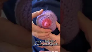 تحجر وإحتقان الثدي بالحليب 