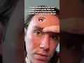 Instantly clear a headache by pressing this one powerful acupressure point This point is