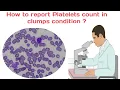 Platelets to do platelets count clumps count manual