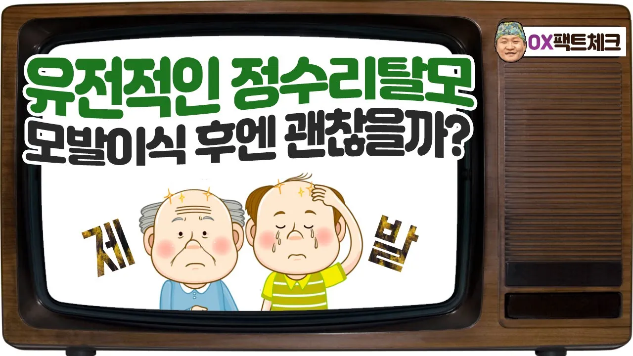 원장님..유전탈모는 모발이식도 하면 안되나요.. [OX팩트체크_19회]