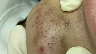                                        دندنها