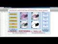 Skin Disease Classification Using CNN Skin Disease Classification Matlab Project With Source Code