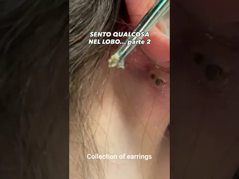 Collection of earrings