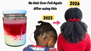 Shocking & Real  Results Registered after Using this , Speed Up Hair Growth and Reduces Hair Loss.