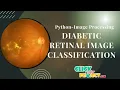 Python Image Processing Project - Diabetic Retinal Image Classification
