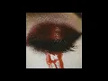 Download Lagu whenthemoonbleeds - i need a doctor