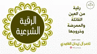 رقية عينا ممرضة الشيخ ناصر زيدان الغامدي 