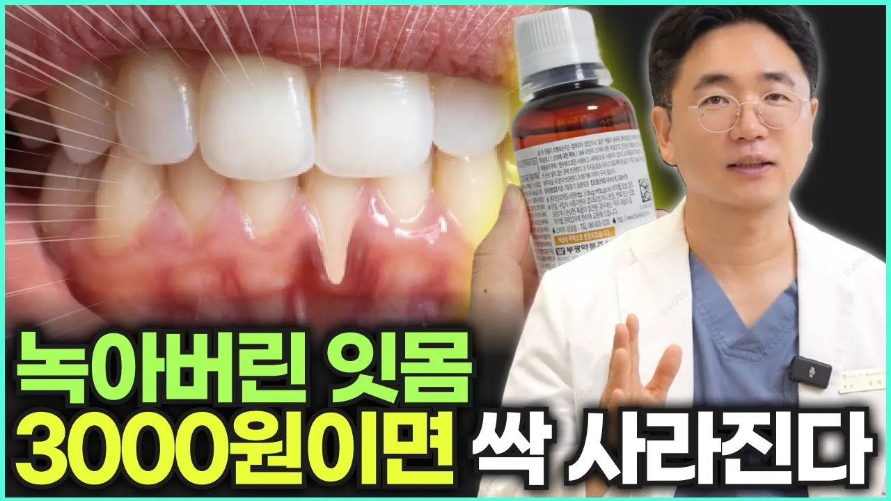 치과 가지 마세요. 녹아내리는 잇몸병 없애는 가장 확실한 방법 | 헥사메딘