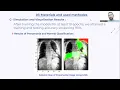 208 Explainability in CNN based Deep Learning models for medical image classification