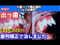 Channel
