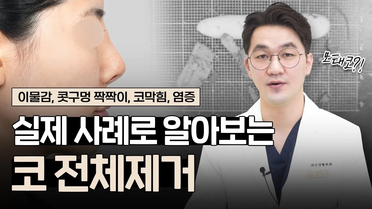 코수술 후 보형물, 코끝연골 제거해도 괜찮을까?|증상별 실제 사례들로 보는 코 전체제거 후기|이물감, 콧구멍짝짝이, 염증, 모태코