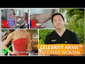 Arm Liposuction Celebrity Arms Lipo 360 Arms Immediate Results Artlipo Expert Dr Thomas Su