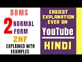 Second Normal Form Explained with Examples ll 2NF and Partial Dependency Explained in Hindi ll DBMS