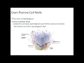 Gram positive and Gram negative Cell Walls