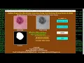 Skin Disease Detection Using CNN Convolutional Neural Network Python OpenCV Project Source Code