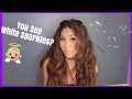 Seeing Sparkles And What They Mean