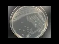 Identification of Unknown Bacteria