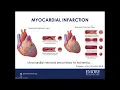 Ischemic or Non-Ischemic Injury Making Sense of Troponin Elevation at the Bedside