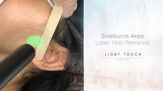 Laser hair removal for women - Sideburns Light Touch Laser Spa NYC Advanced Laser Treatments